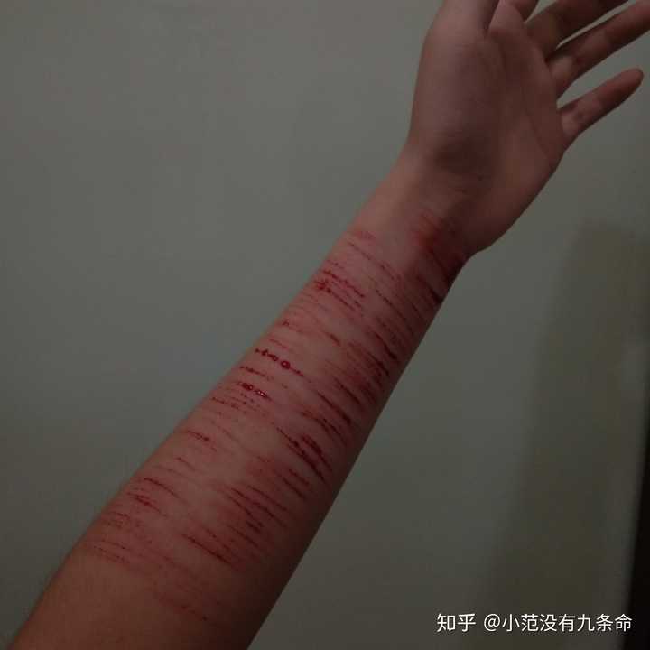 自残游戏有哪几种_自残小游戏_自残的手机游戏