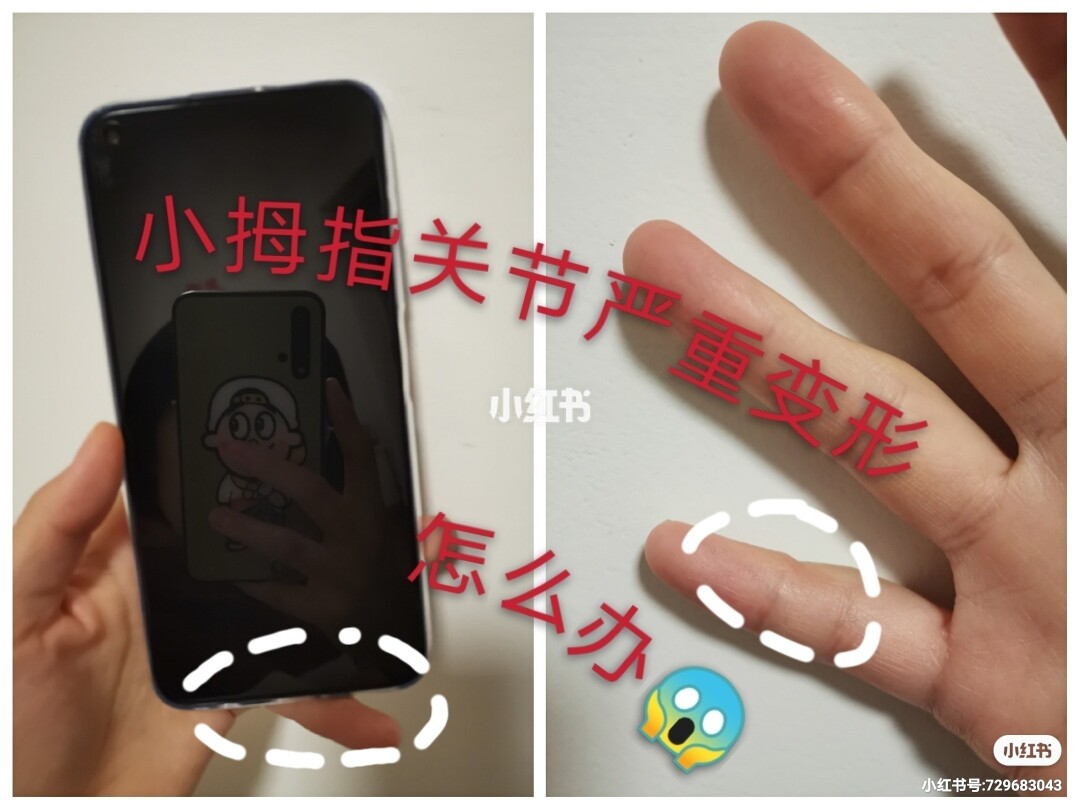玩游戏气得砸手机_玩游戏砸电视_玩游戏时砸手机合集视频