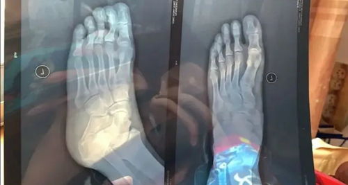 修脚趾游戏,游戏简介(图11)