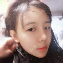 隆鼻游戏,鼻型美学与整形技巧(图3) 隆鼻游戏,鼻型美学与整形技巧(图3)