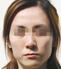 面瘫恢复游戏,游戏助力重拾微笑(图2) 面瘫恢复游戏,游戏助力重拾微笑(图2)