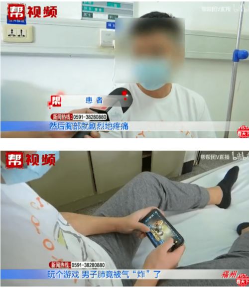 打游戏气胸,警惕电竞健康风险(图3) 打游戏气胸,警惕电竞健康风险(图3)