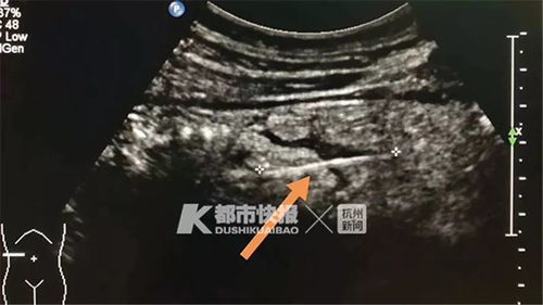 取牙签游戏,一场指尖上的智慧对决(图1) 取牙签游戏,一场指尖上的智慧对决(图1)