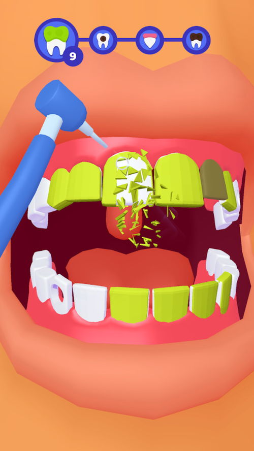 牙医的游戏,口腔护理的趣味之旅(图3) 牙医的游戏,口腔护理的趣味之旅(图3)