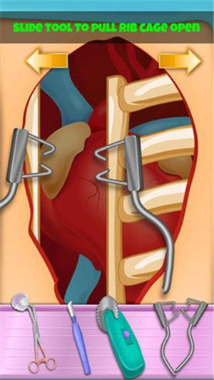 心脏手术游戏,心脏手术游戏体验揭秘(图2)